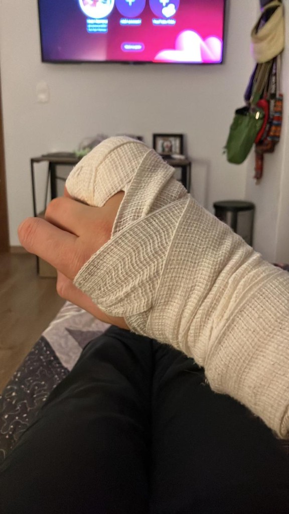 Hand bandage